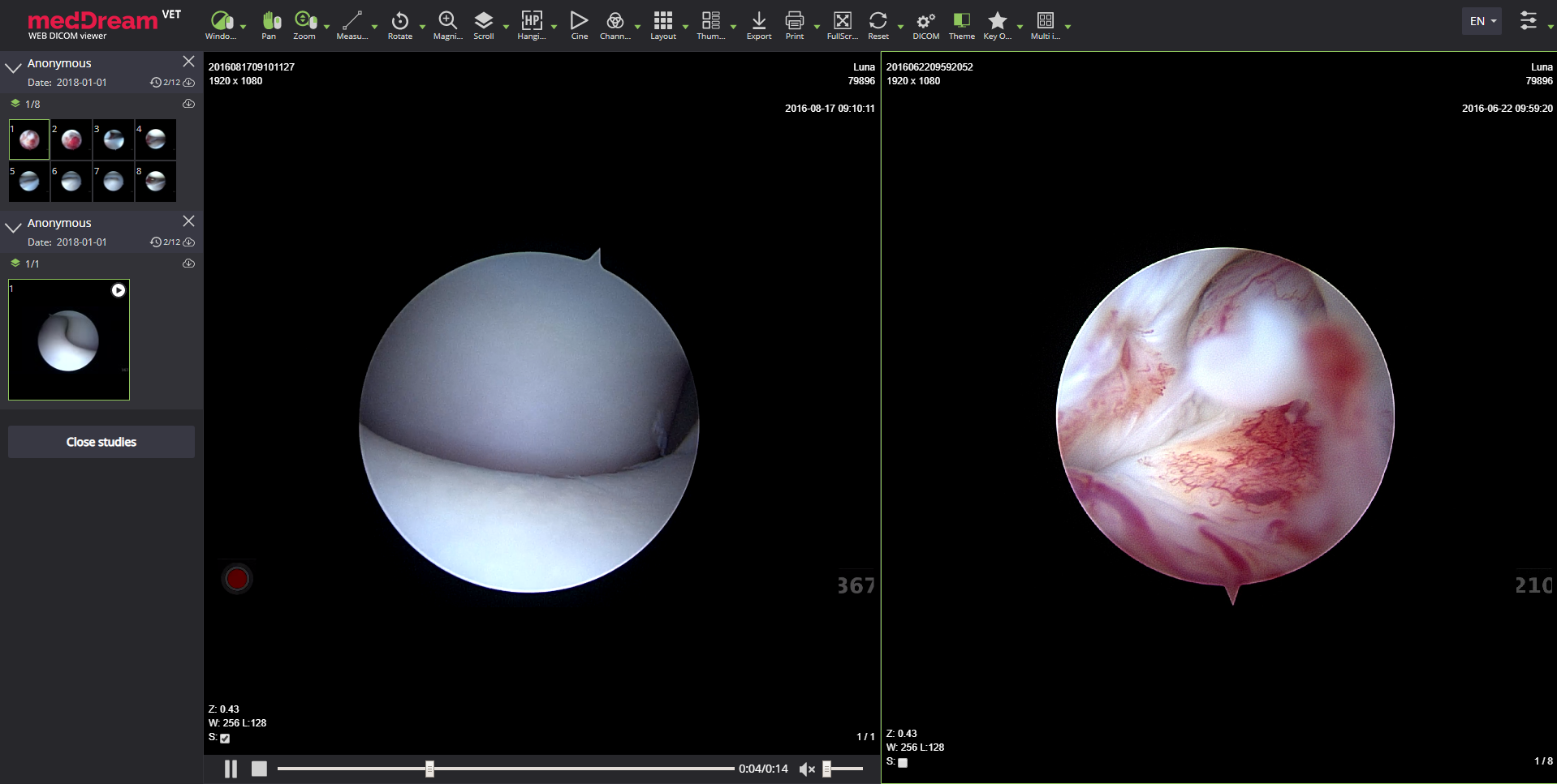 meddream vet dicom viewer es us video